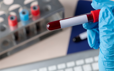 Controle de Qualidade em Hemoterapia
